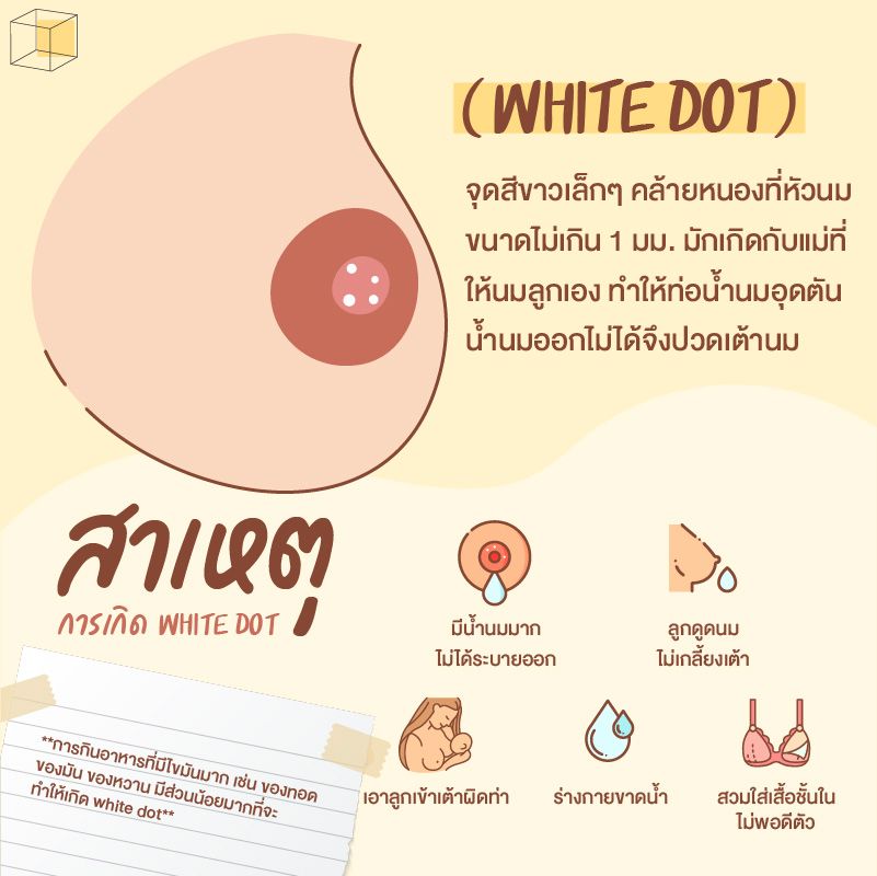 White Dot จุดขาวเล็ก ๆ ที่หัวนม ปัญหาของคุณแม่ที่ให้นมลูกเอง | Cottonbaby