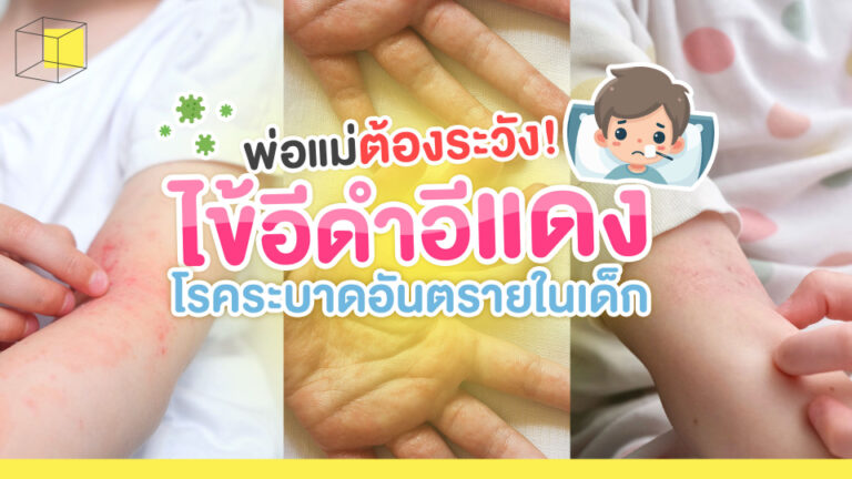 โรคไข้อีดำอีแดง